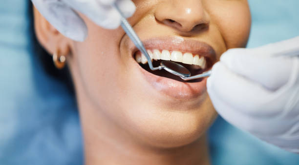 Best Emergency Dentist for Knocked-Out Tooth in Cricket, NC