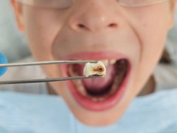 Best Emergency Dental Services for Seniors in Cricket, NC
